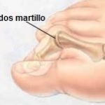 RATONCITO A MEDIDA